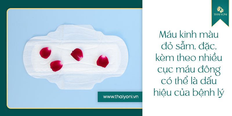 Màu kinh nguyệt nói lên điều gì? 6 dấu hiệu Nàng cần biết 2 Mau kinh mau do sam dac kem theo nhieu cuc mau dong co the la dau hieu cua benh ly